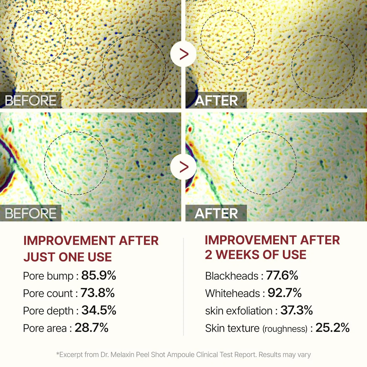 Dr. Melaxin Peel Shot (Pack of 2)
