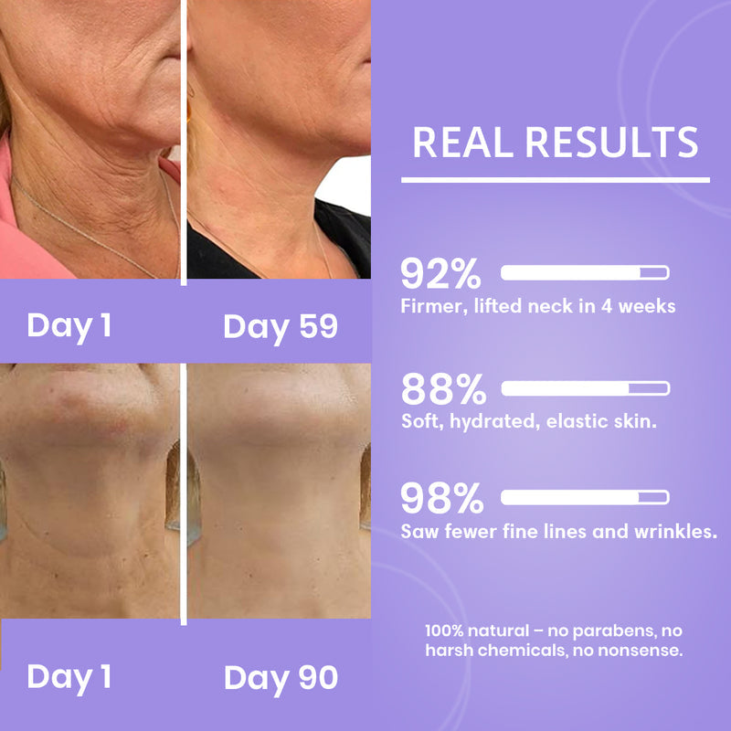 كريم شد ورفع الرقبة